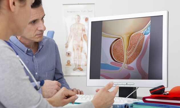 Suchen Sie einen Arzt auf, wenn ein pathologischer Ausfluss aus dem Penis vorliegt